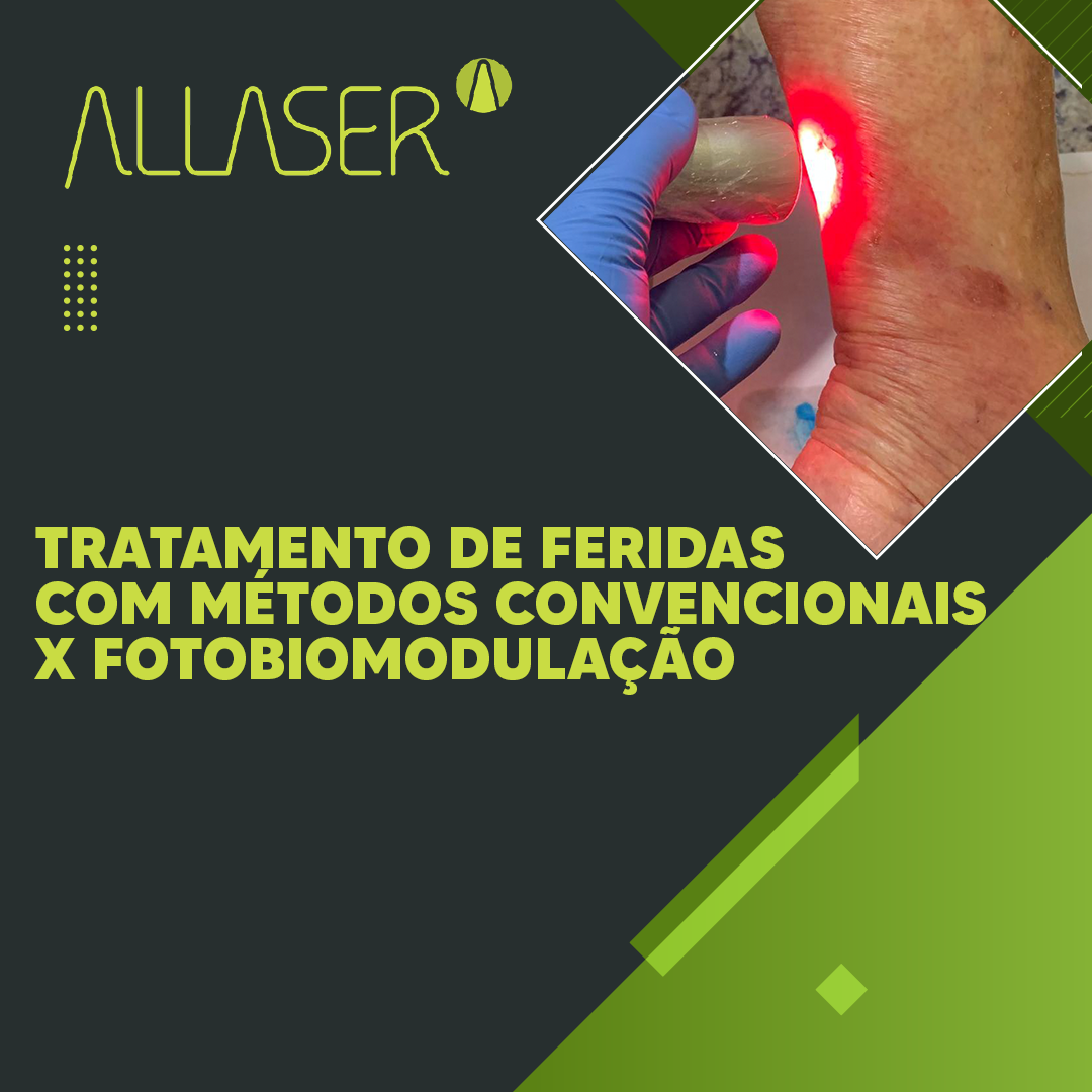 Tratamento de feridas com métodos convencionais x Fotobiomodulação
