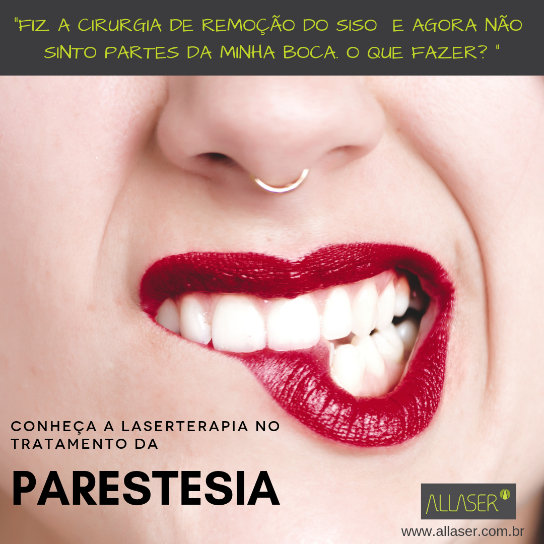 Parestesia – tratamento com Laserterapia