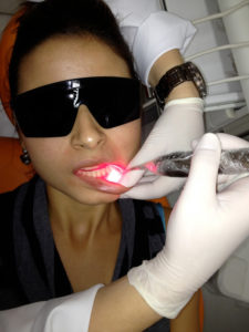 Profissional usando óculos de proteção durante a aplicação do laser